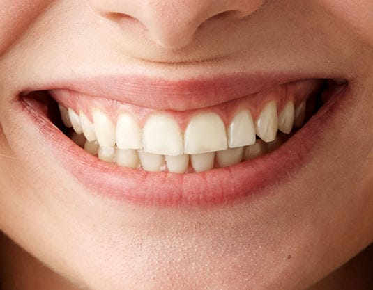 Closeup Teeth Image