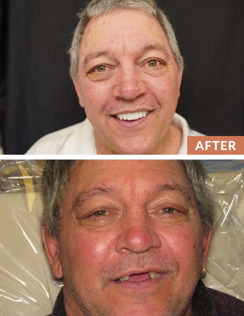 Before and After Transformation
