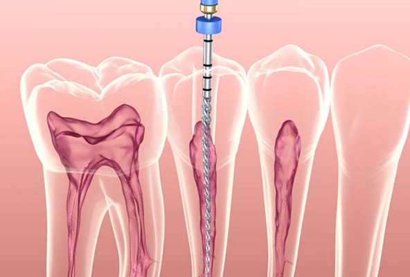 Endodontics