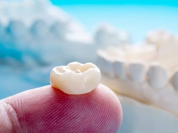 Process of Dental Crowns