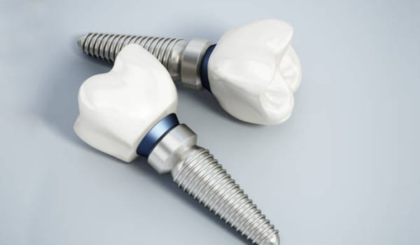 Dental Implant Failure