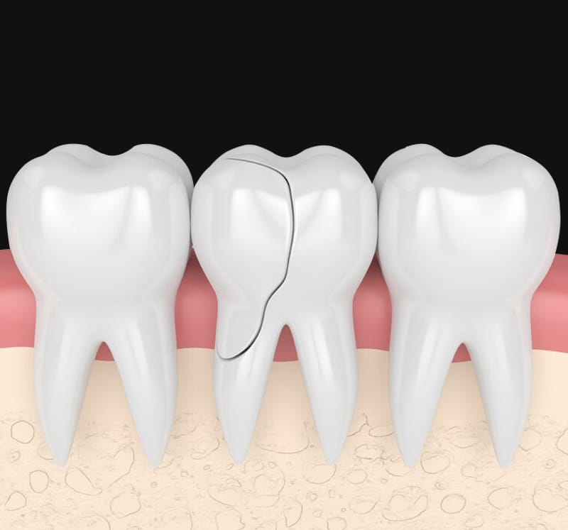 Emergency Dentistry