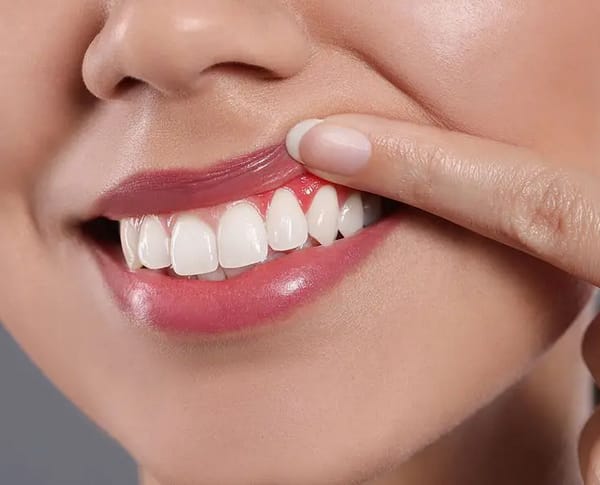 Indications and Symptoms of Gum Disease