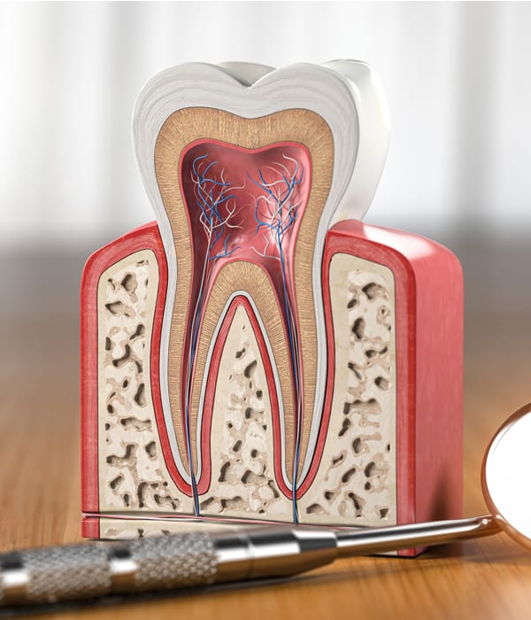 Root Canal Therapy