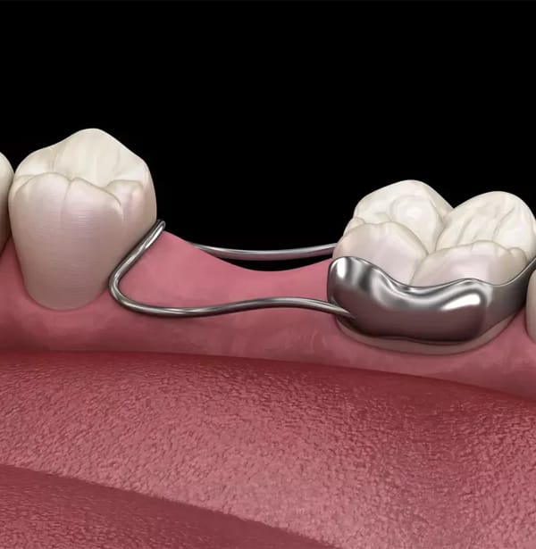 Importance of Baby Teeth and the Role of Space Maintainers
