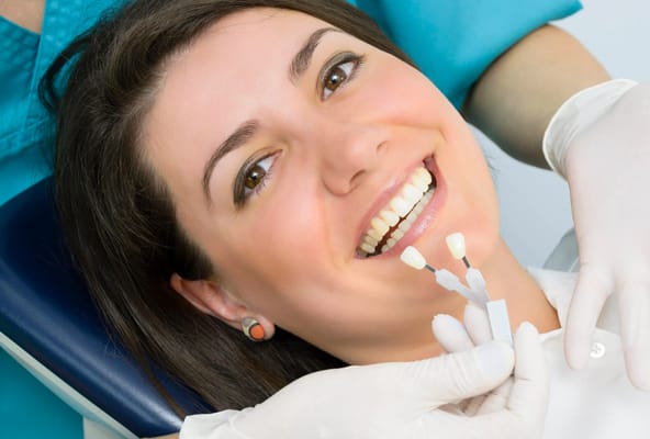 Veneers