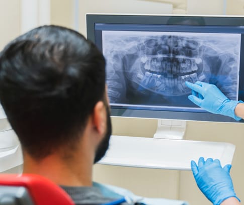 X-Rays