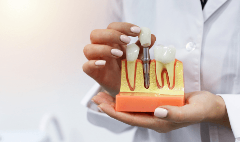 How to Care for Your Dental Implants: Maintenance Tips