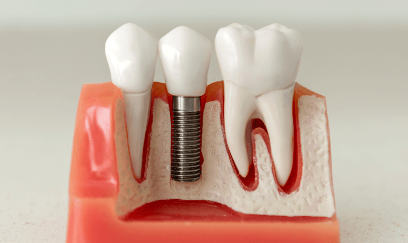 Navigating Dental Emergencies for Seniors: Overcoming Challenges