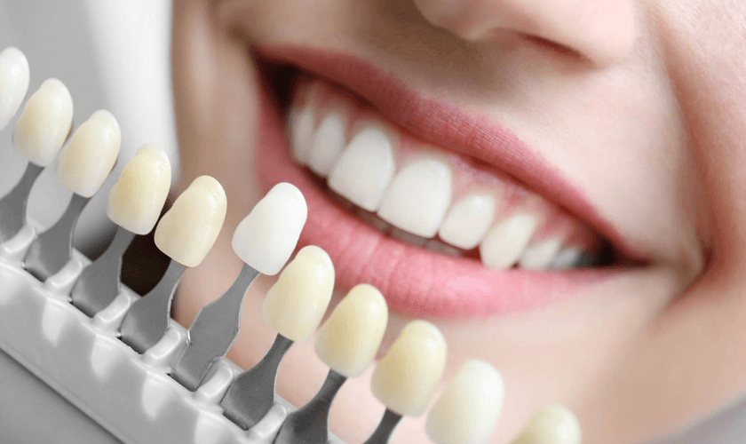 Are Dental Veneers the Right Choice for You
