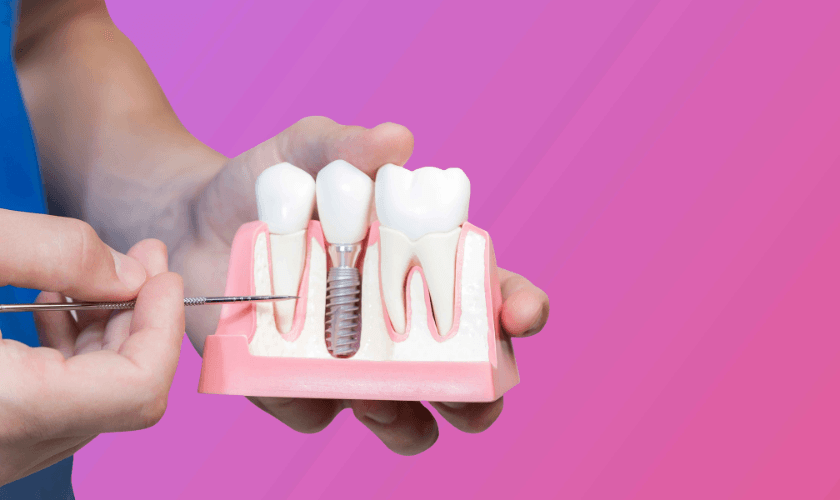 Do Dental Implants Look and Feel Like Real Teeth
