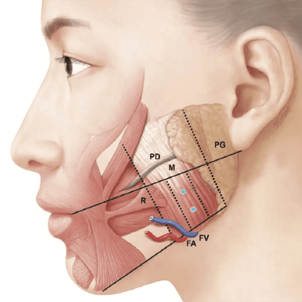 Botox for TMJ Treatment